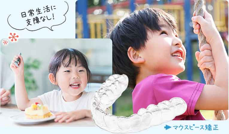 6歳からはじめるインビザラインファースト