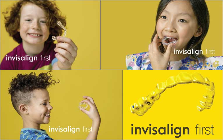 インビザライン®ファースト