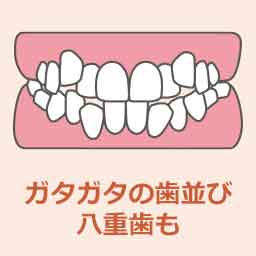 叢生